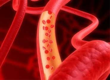 Angiologia e Cirurgia Vascular