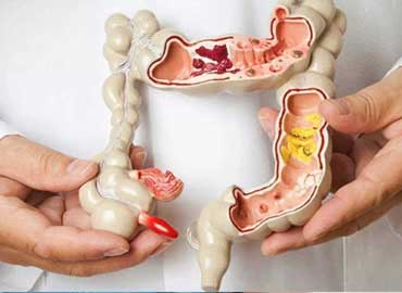 Coloproctologia