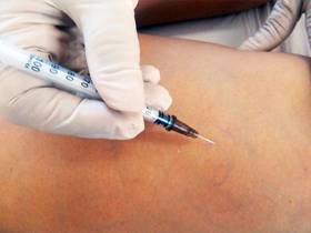 3 tratamentos para acabar com as varizes